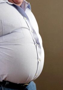 چاقی شکمی در افراد دارای سندروم متابولیک مشهود است