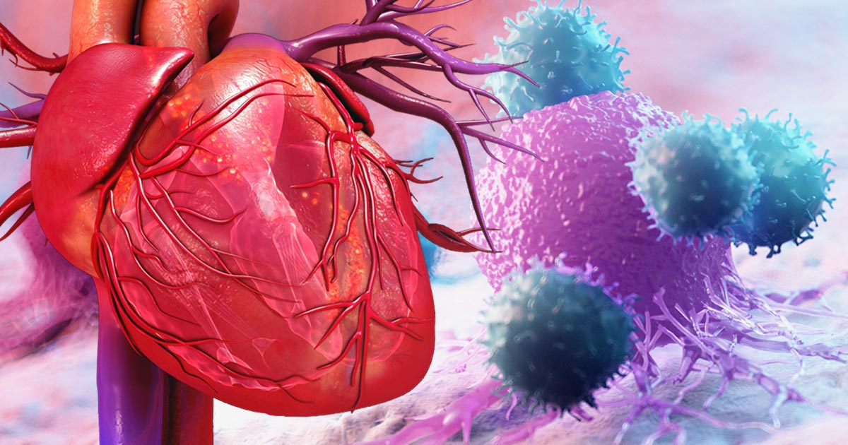 کاردیو انکولوژی یک شاخه میان رشته ای از قلب و سرطان است